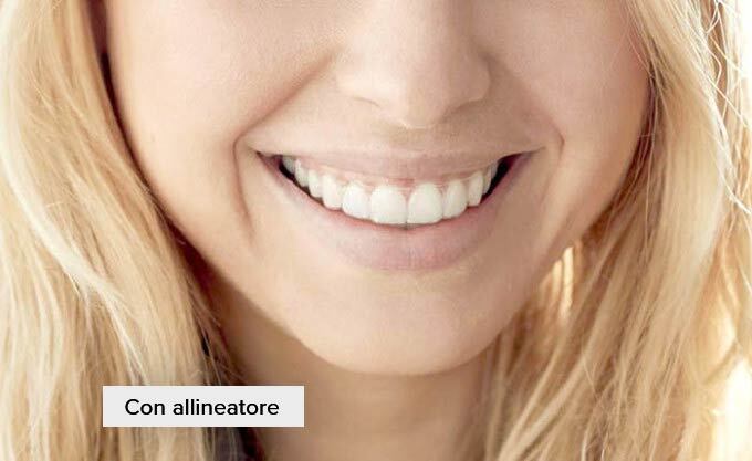 Con-allineatore