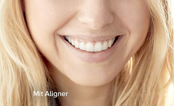 Image Retainer