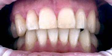 Resizable image right