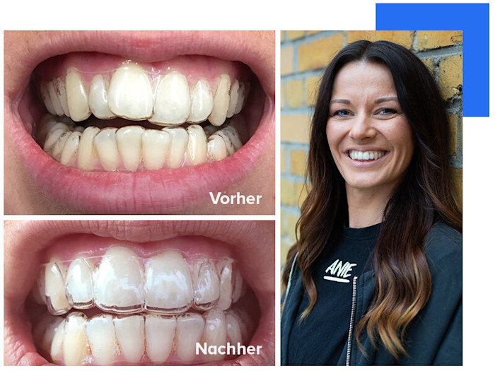 stephanie beforeafter