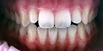 Resizable image right