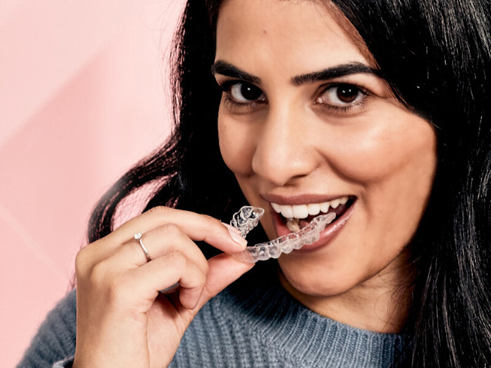 Frau Zahnschiene Clear Aligner Lächeln Anwendung LP Retargeting