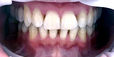 Resizable image right