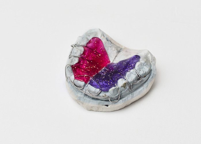 Aparato dental removible