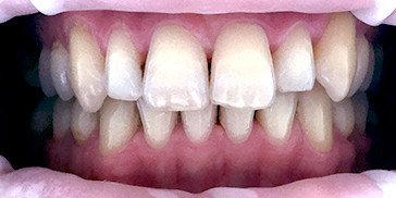 Resizable image right