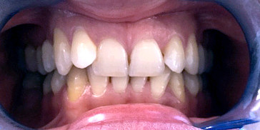 Resizable image left