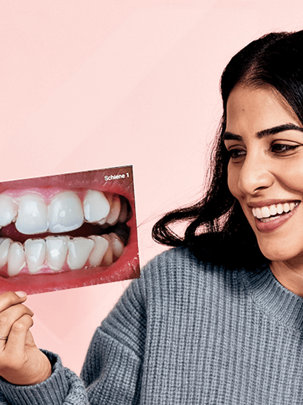 DrSmile Zahnschiene vorher nachher Sinim