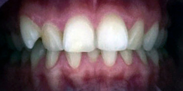 Resizable image left