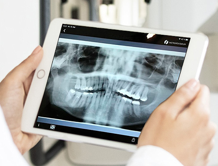 X-ray