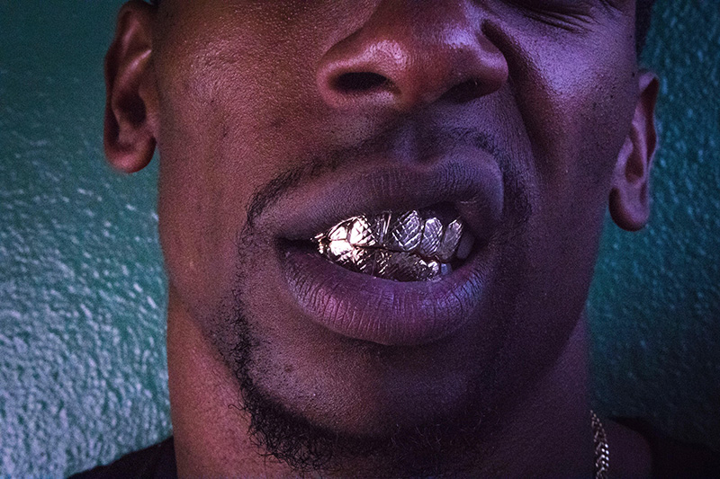 Grillz anfertigen